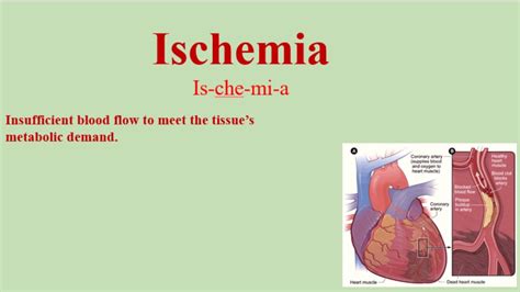 ischemia meaning in hindi|More.